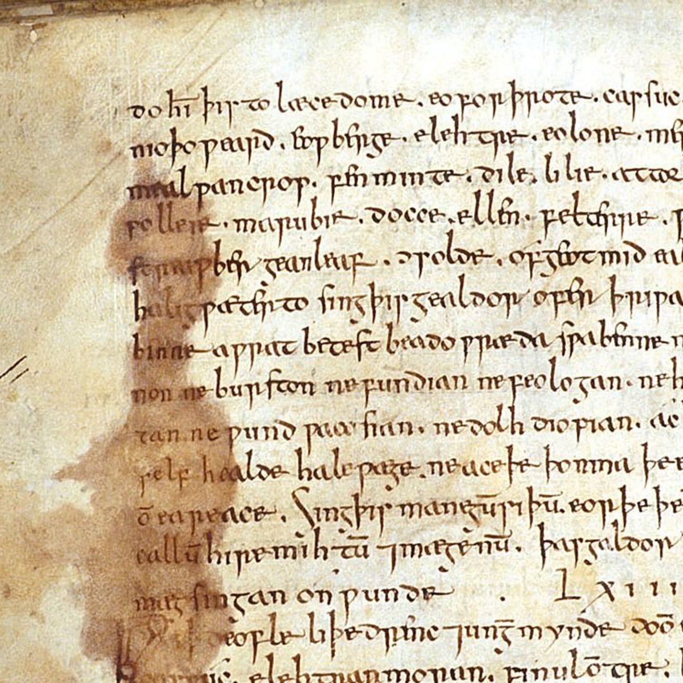 Staph Retreat by WNYC Studios