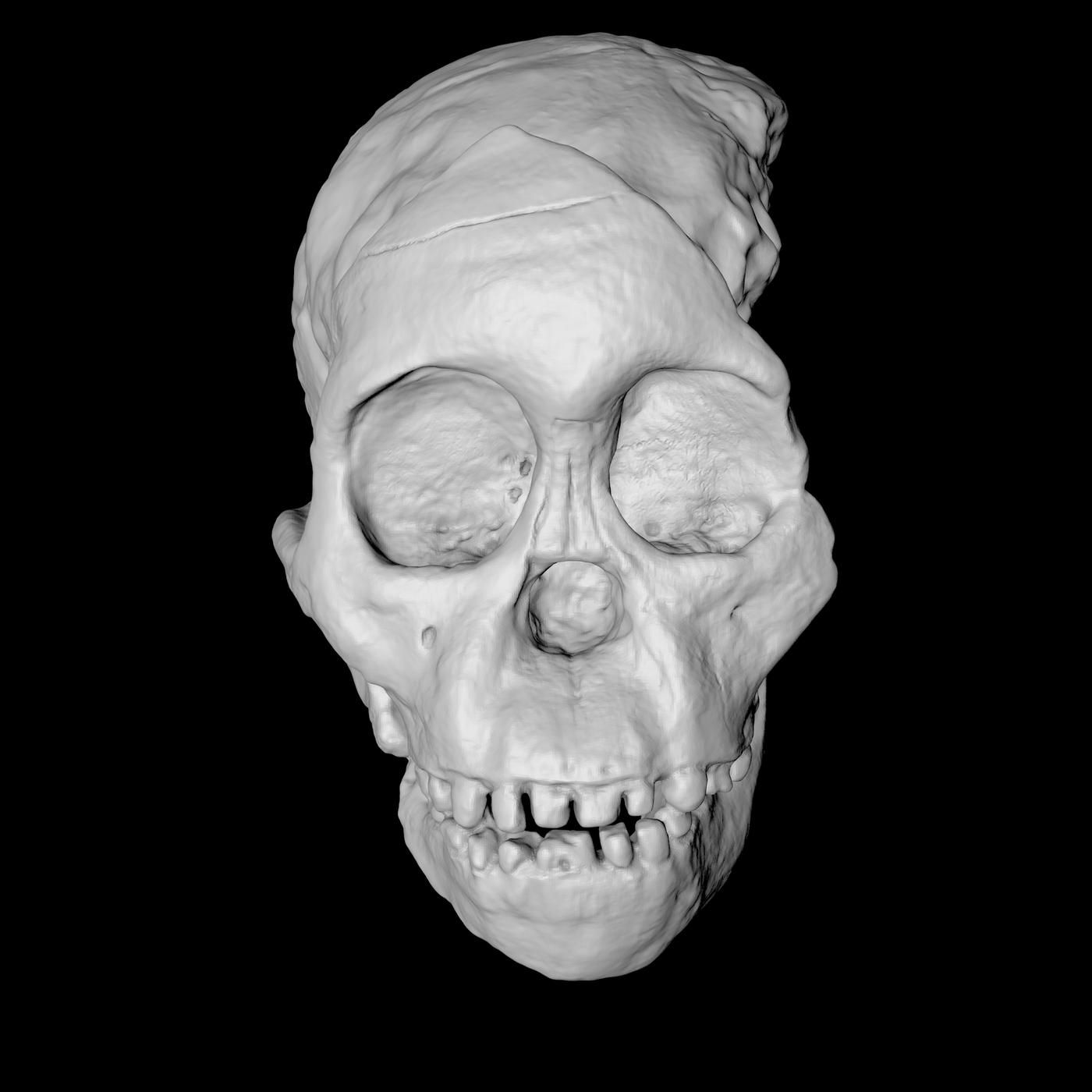 The Skull by WNYC Studios