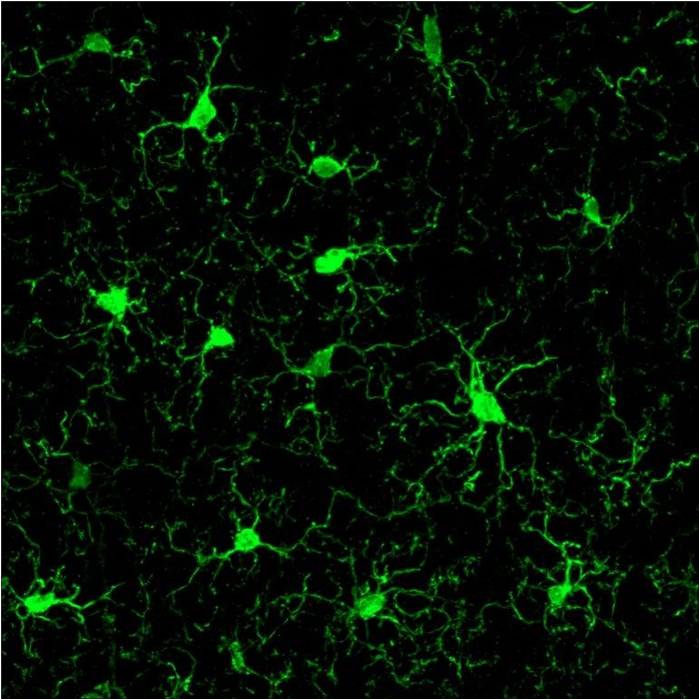 Bringing Gamma Back, Again by WNYC Studios