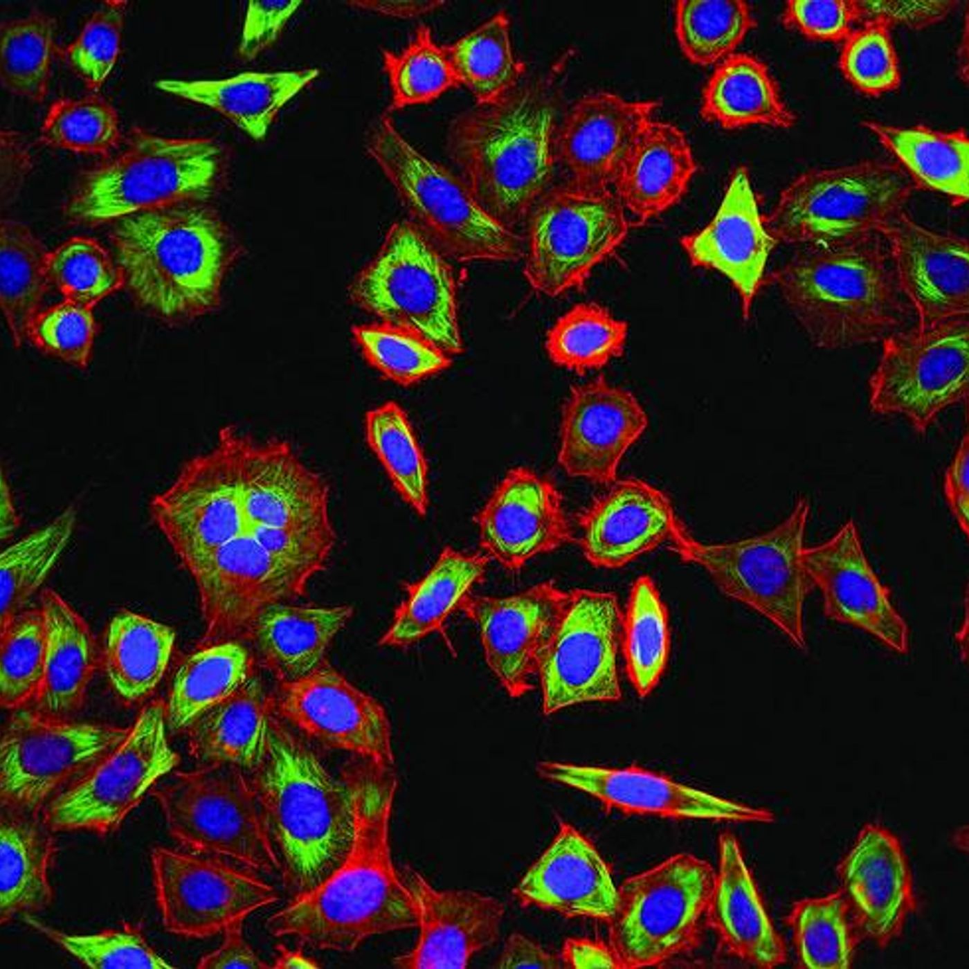 Famous Tumors by WNYC Studios