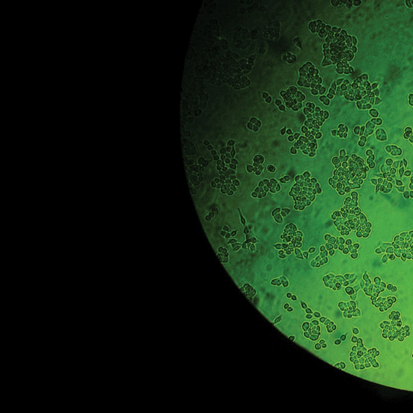 UPDATE: Famous Tumors by WNYC Studios