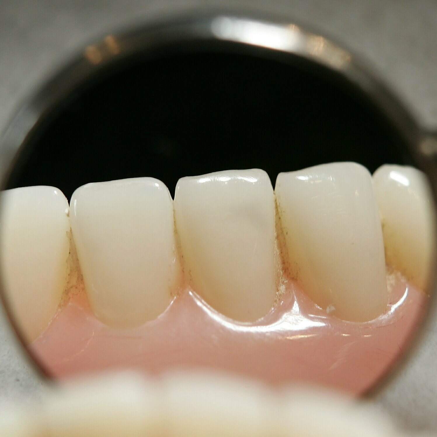 The value of good teeth by NPR