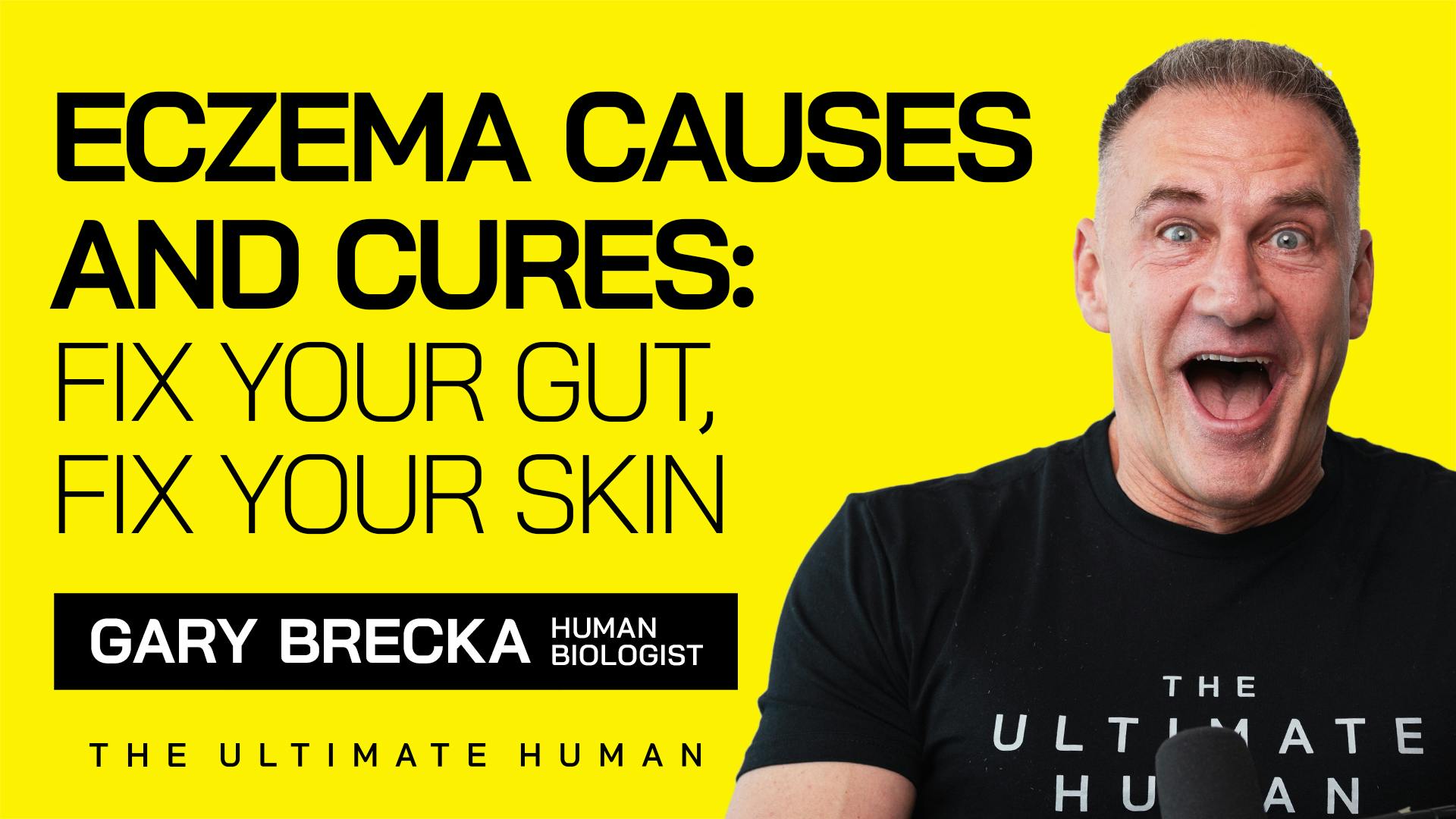 176. Why Your Eczema Isn’t Just Skin Deep...Here’s the REAL Cause! by Gary Brecka